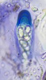 Fuscidea thomsonii image