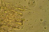 Mucronella bresadolae image