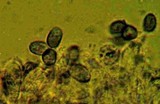 Mucronella bresadolae image