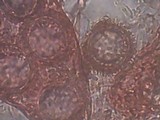 Genabea cerebriformis image