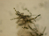 Neurospora crassa image