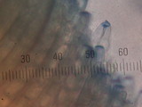 Peziza vesiculosa image