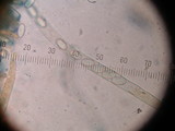 Peziza vesiculosa image