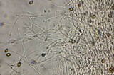 Psilocybe subaeruginascens image