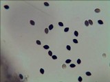 Panaeolus papilionaceus var. parvisporus image