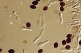 Panaeolus acuminatus image