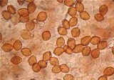 Psilocybe aerugineomaculans image