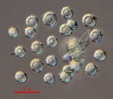 Tulostoma clathrosporum image