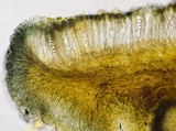 Lecidella elaeochroma f. elaeochroma image