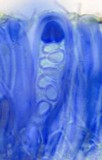 Lecidella elaeochroma f. elaeochroma image