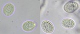 Lecidella elaeochroma f. elaeochroma image