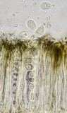 Lecidella elaeochroma f. elaeochroma image