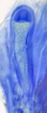 Lecidella elaeochroma f. elaeochroma image