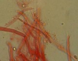 Mycena metata image