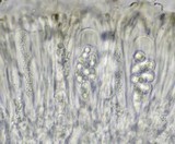 Lecanora chlarotera image