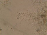 Basidiodendron eyrei image