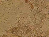 Aleurodiscus aurantius image