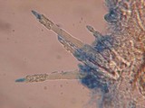 Tubulicrinis subulatus image
