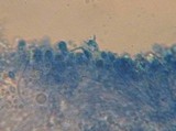 Multiclavula mucida image