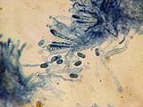 Vuilleminia cystidiata image