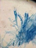 Vuilleminia cystidiata image