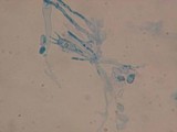Vuilleminia cystidiata image