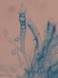 Vuilleminia cystidiata image