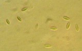 Lachnellula agassizii image