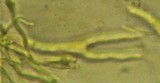 Dacrymyces stillatus image
