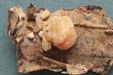 Tremella encephala image