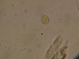 Dacrymyces ovisporus image