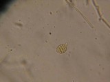 Dacrymyces ovisporus image