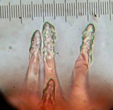 Melanoleuca evenosa image