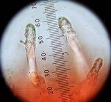 Melanoleuca evenosa image