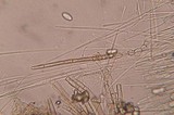Tricharina ochroleuca image