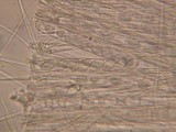 Tricharina ochroleuca image