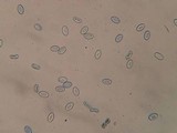 Tricharina ochroleuca image