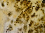 Choiromyces alveolatus image