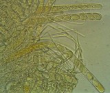 Geopyxis vulcanalis image