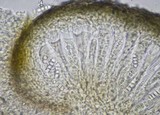 Arthonia phaeobaea image