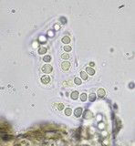 Arthonia phaeobaea image