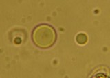 Chrysomphalina aurantiaca image
