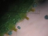 Puccinia monoica image