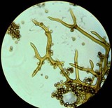 Calbovista subsculpta image