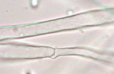 Hemimycena cucullata image