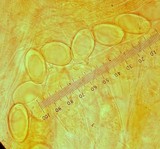 Disciotis venosa image