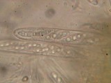 Dencoeliopsis johnstonii image