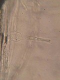 Coprinellus xanthothrix image