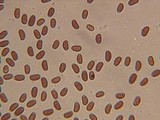 Coprinellus xanthothrix image