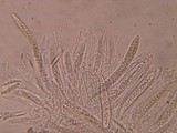 Massariosphaeria grandispora image